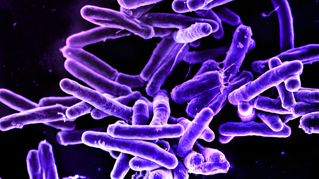 Lila eingefärbte mikroskopische Aufnahme des Tuberkuloseerregers