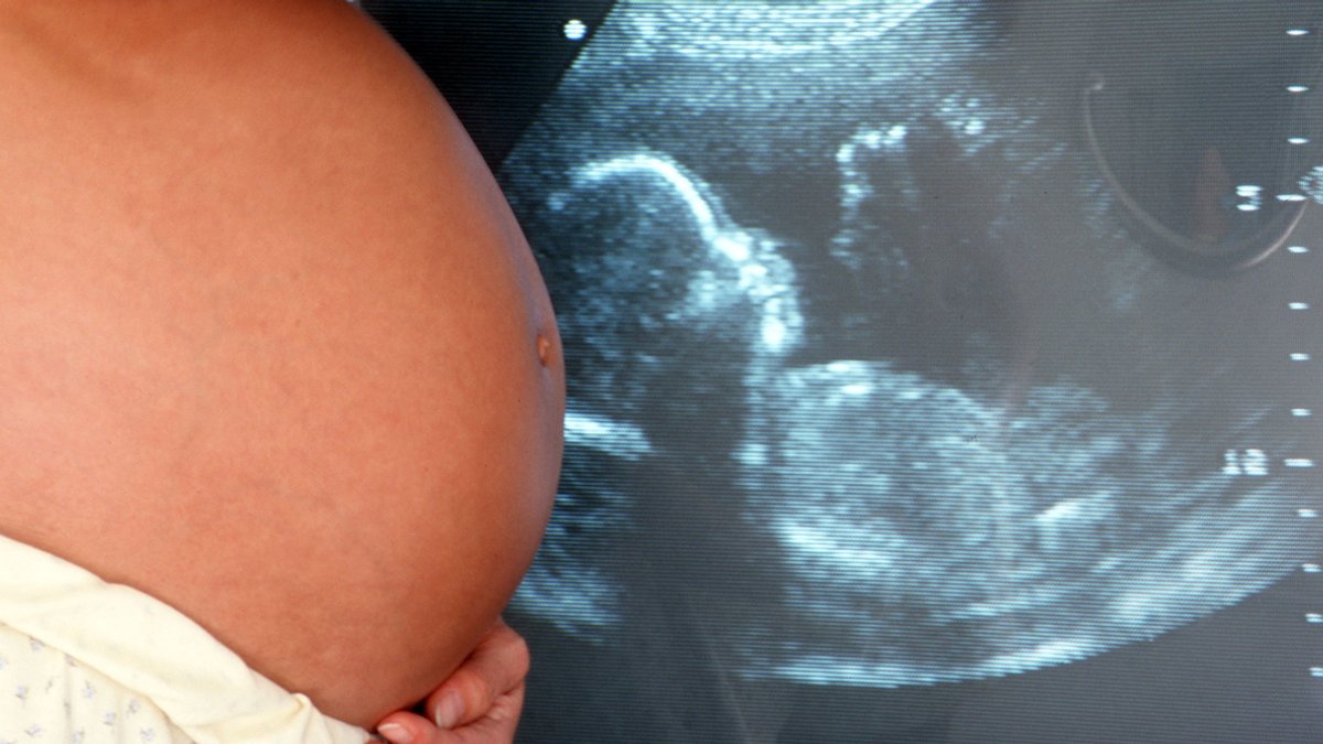 Haben Schwangere ein höheres Risiko für Thrombosen bei Covid-19?