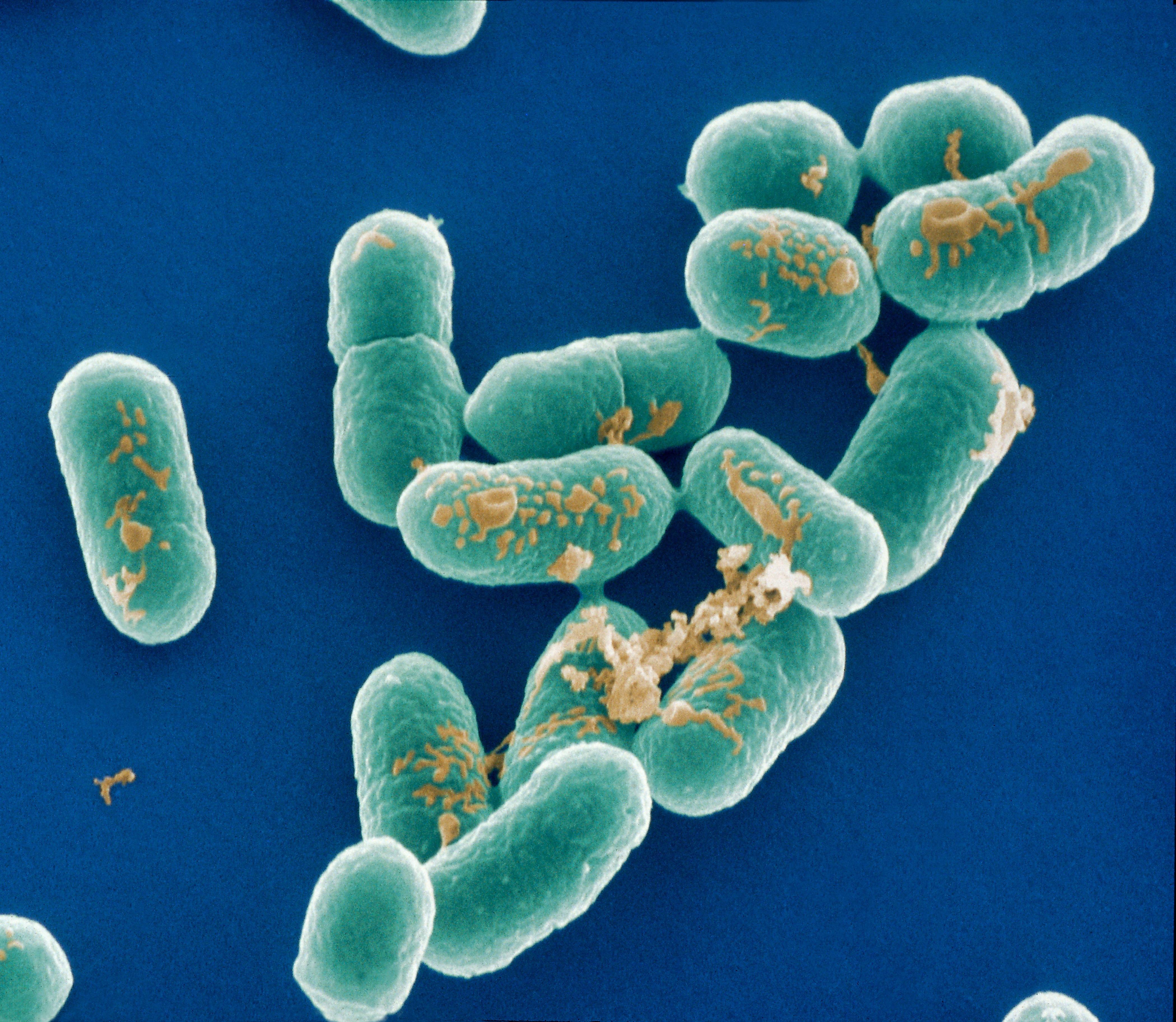 Listerien (Listeria monocytogenes) Erreger der Listeriose, in Mikroaufnahme