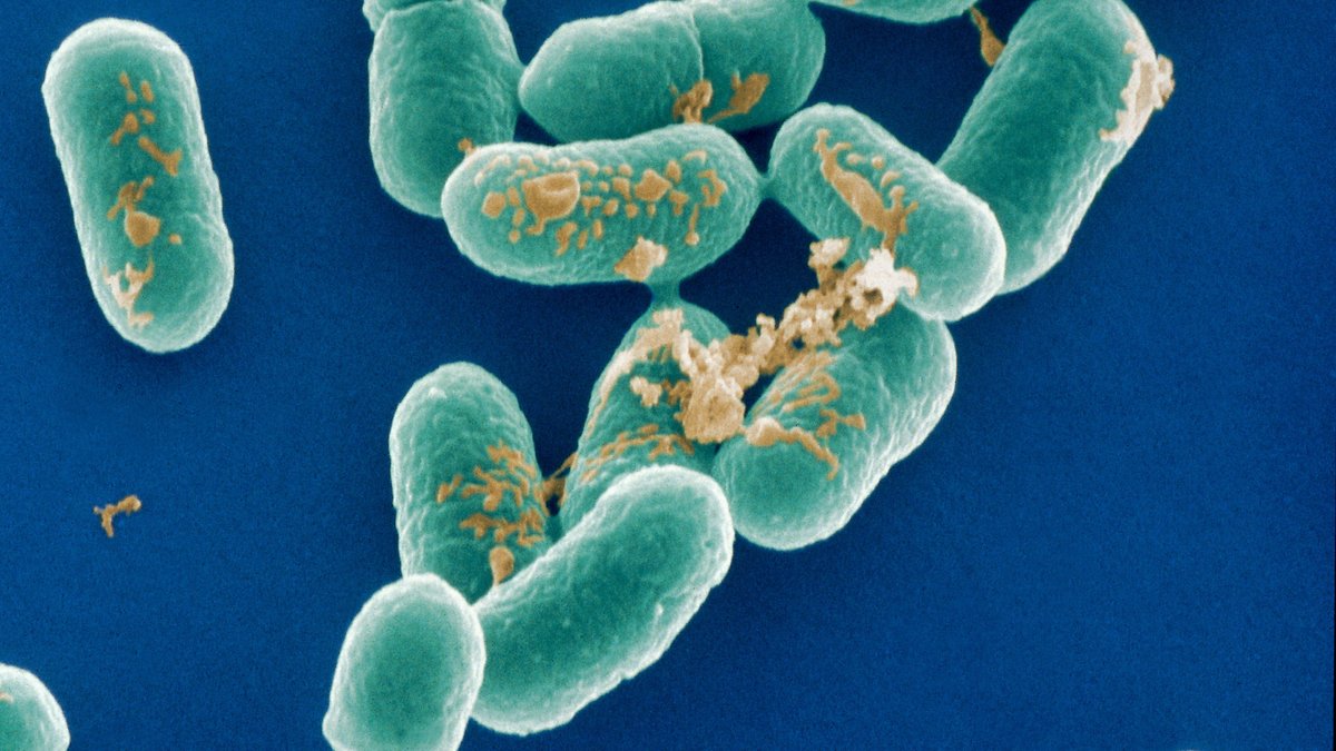 Listerien (Listeria monocytogenes) Erreger der Listeriose, in Mikroaufnahme | Bild: picture alliance / OKAPIA KG, Germany | Dr. Gary Gaugler Listerien (Listeria monocytogenes) Erreger der Listeriose, in Mikroaufnahme