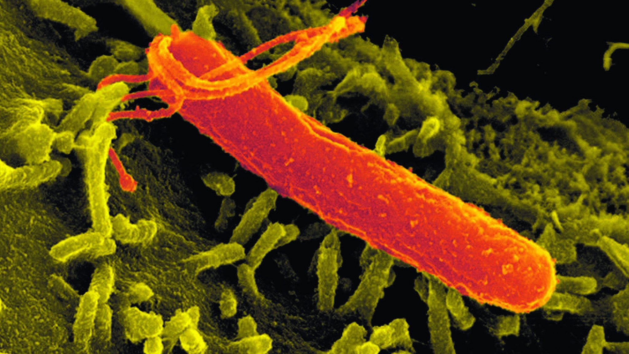 Bakterium Helicobacter pylori