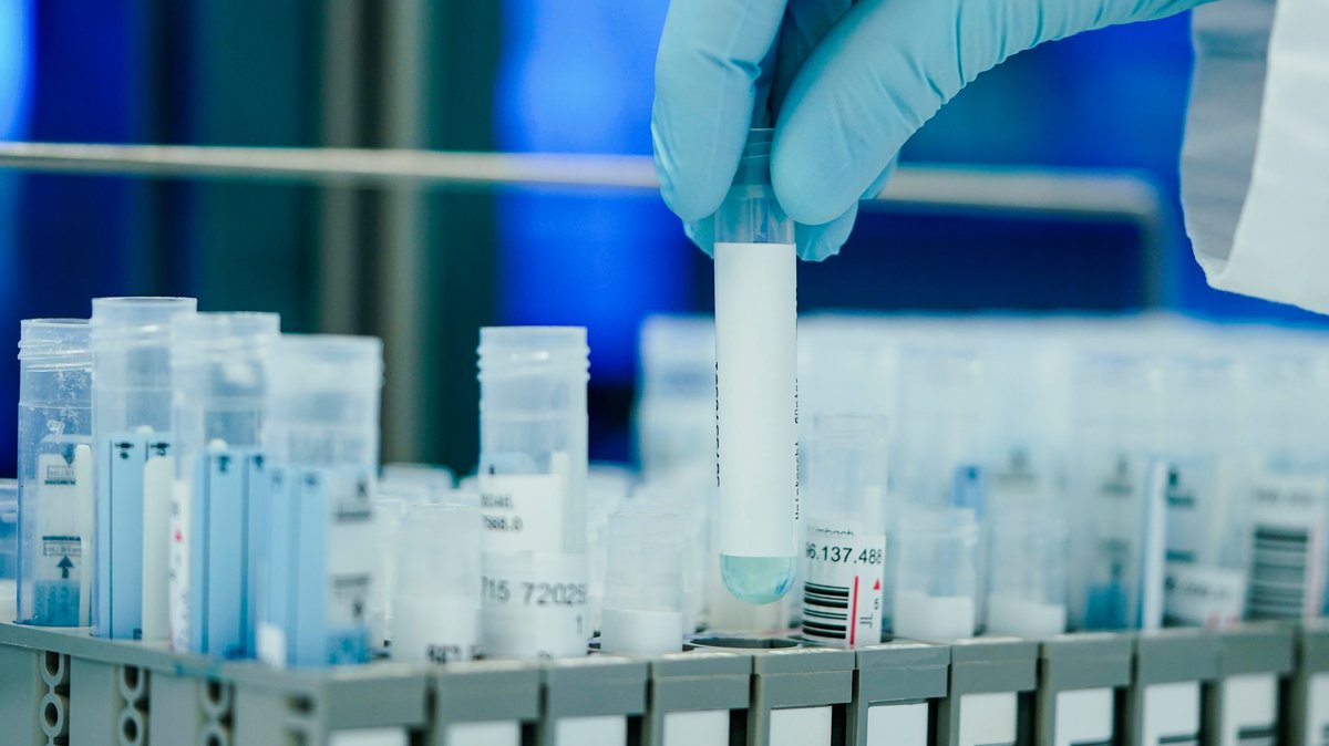 Heidelberg: Ein Mitarbeiter hält in einem Coronatest-Labor PCR-Teströhrchen in den Händen.