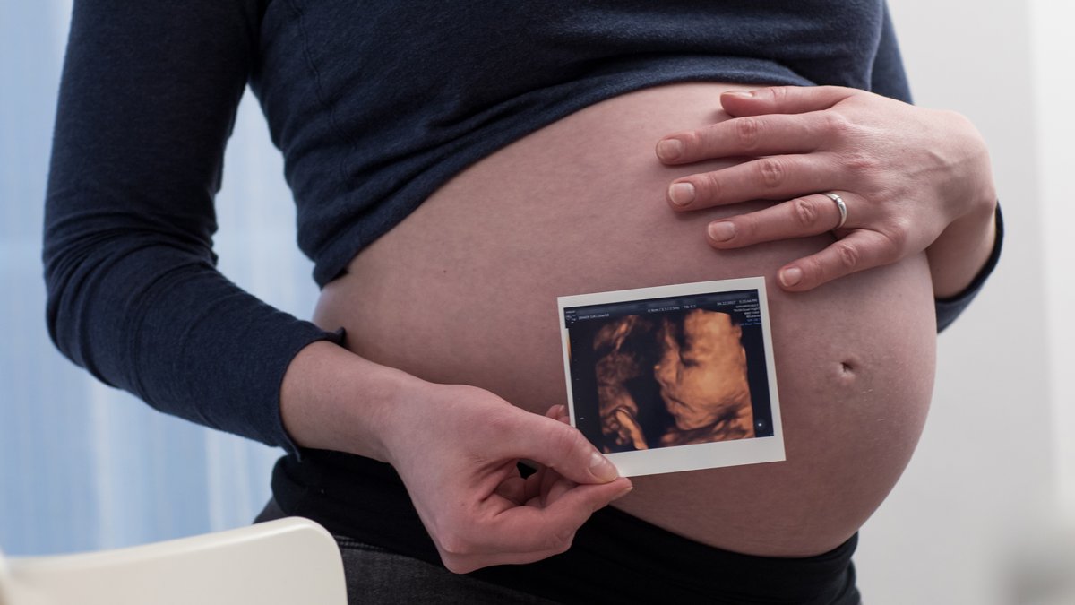 Schwangere zeigt das 3D-Ultraschallbild ihres ungeborenen Kindes