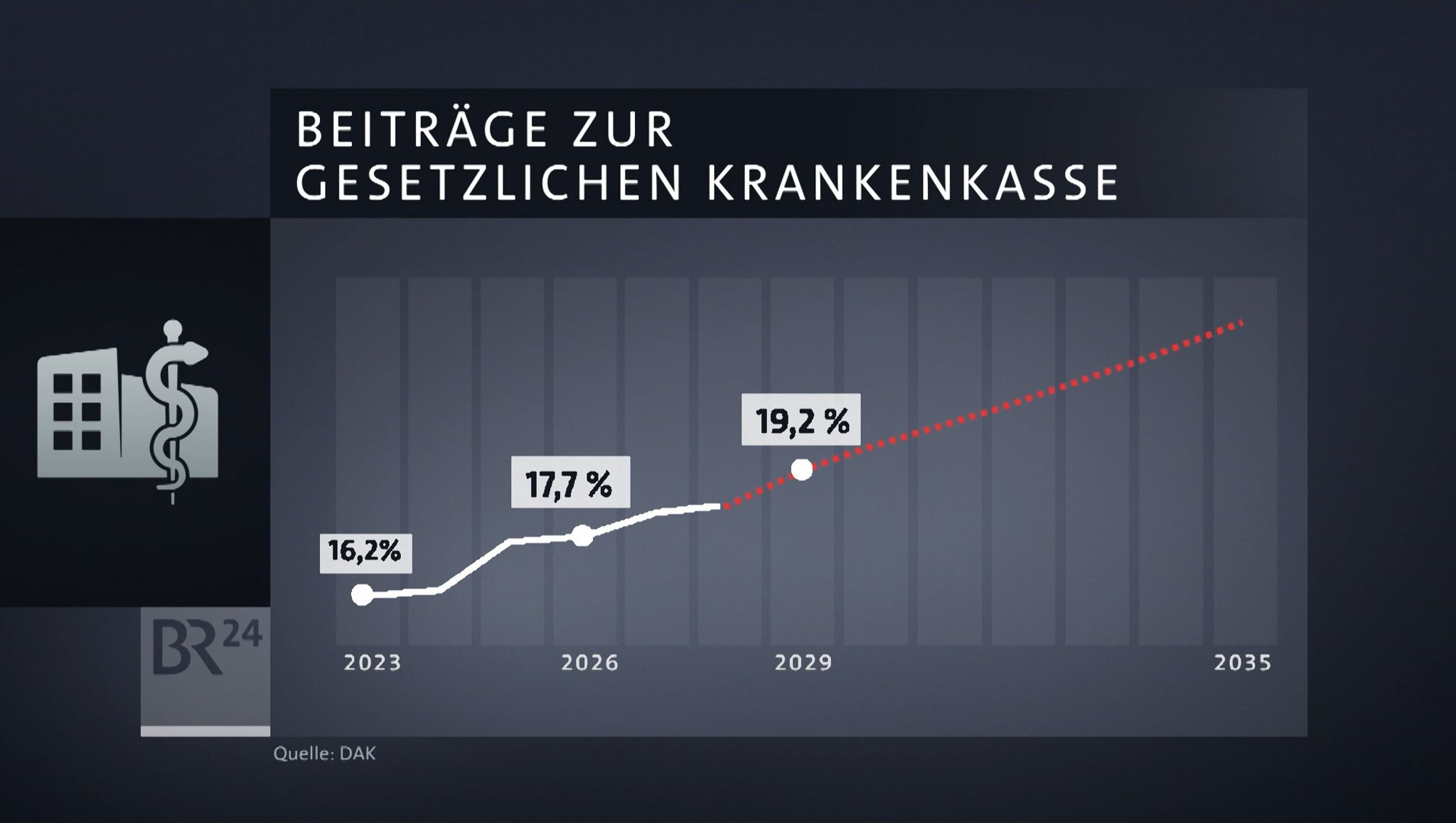Wie lassen sich neue Milliardenlöcher im Gesundheitssystem verhindern? Eine Expertenkommission hat nun Vorschläge vorgelegt.