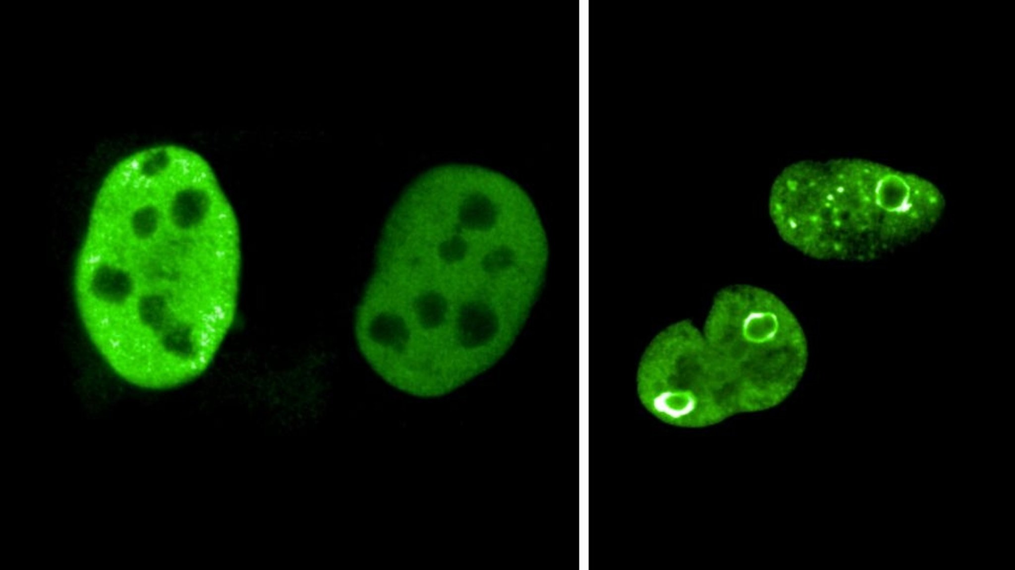 MYC-Proteine sind in dieser Abbildung grün gefärbt. In normal wachsenden Zellen sind sie gleichmäßig im Zellkern verteilt (links). In vielfältigen Stress-Situationen, wie sie in Krebszellen vorkommen, lagern sie sich um, bilden kugelartige Strukturen und umgeben damit besonders gefährdete Abschnitte des Genoms.