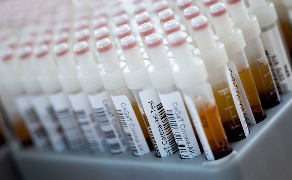 Blutentnahmeröhrchen mit Blutproben für einen Corona-Antikörper-Test des Tübinger Humangenetik-Labors CeGaT stehen in einem Rack (Archivbild)