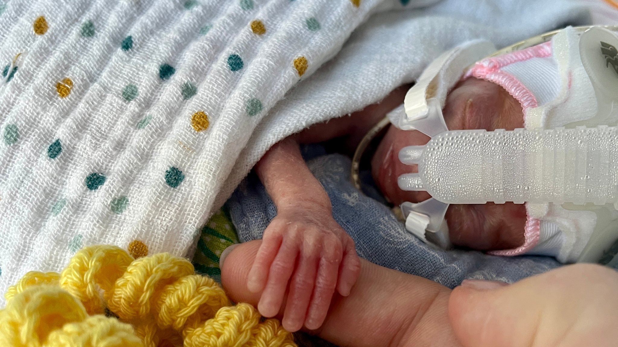 Das frühgeborene Baby Marie in der Kinderklinik Passau.