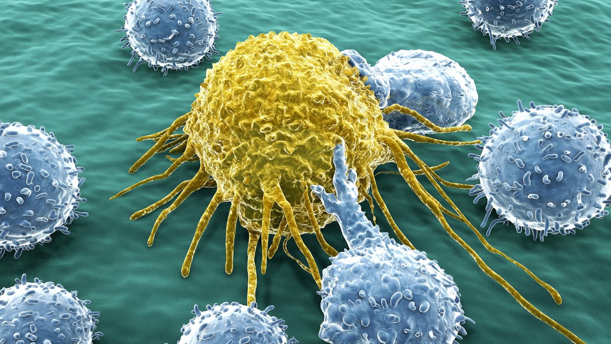 Illustration einer Krebszelle, die von Lymphozyten angegriffen wird. Immuntherapie soll das körpereigene Immunsystem dabei stärken, Krebs zu bekämpfen