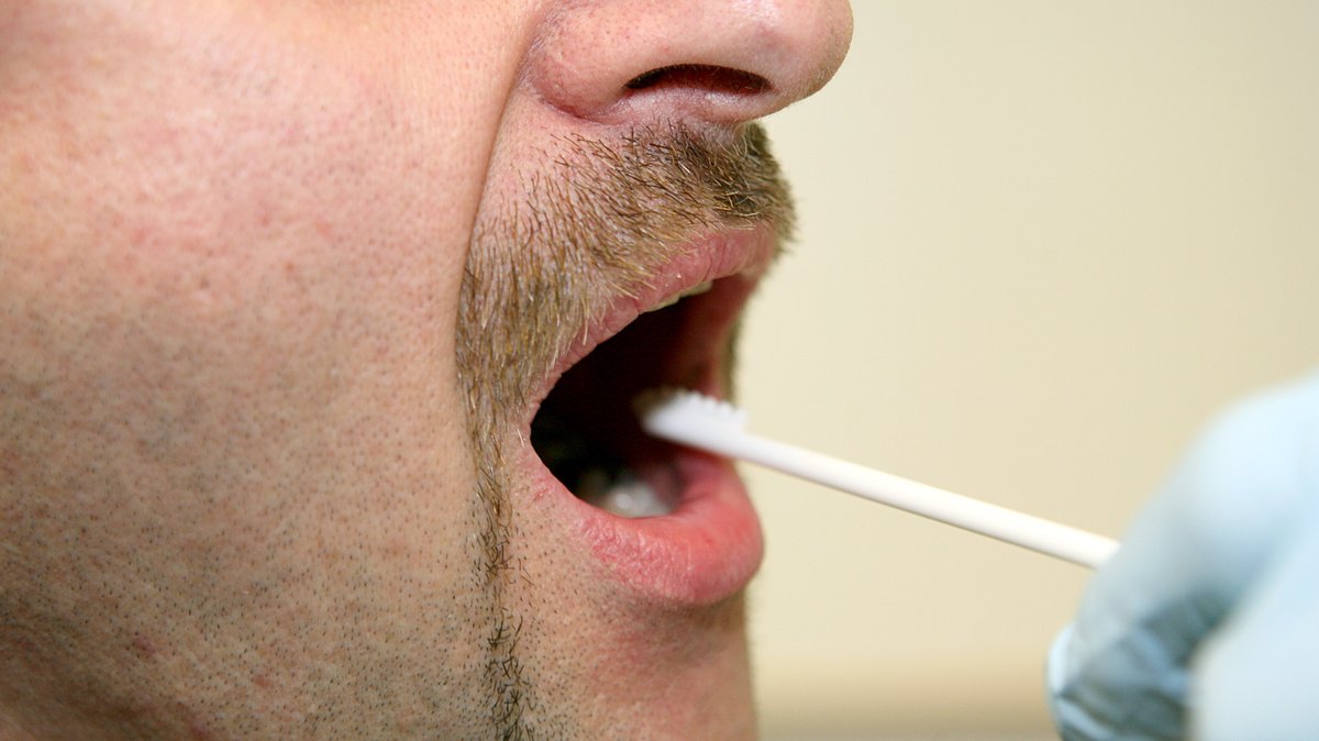 Ein Mann öffnet den Mund für einen Test mit einem Stäbchen