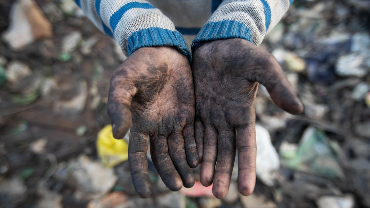 Ein Zehnjähriger, der auf einer Mülldeponie arbeitet, zeigt seine schmutzigen Hände. 