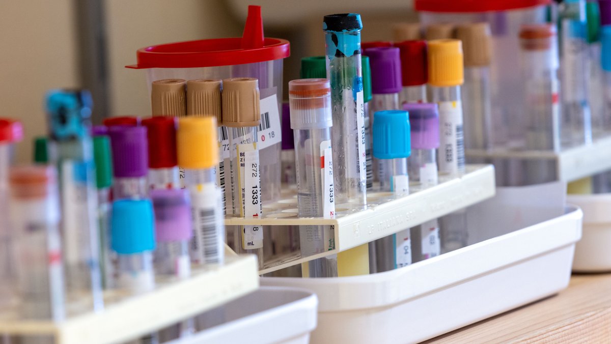 Sammlung von Labor-Gefäßen mit verschiedenen Proben von Teilnehmern einer medizinischen Studie.