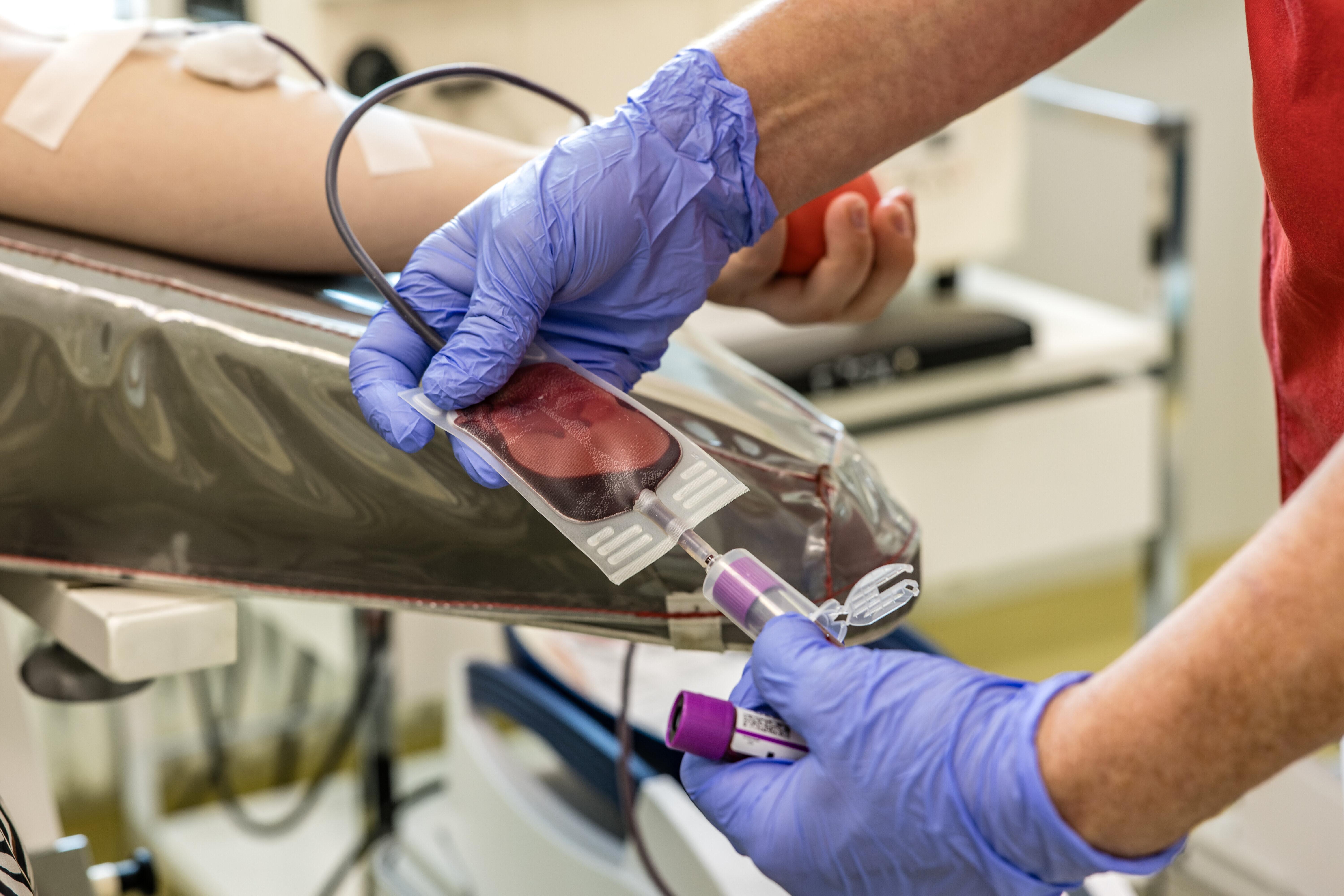 Blut wird für einen Test von einer Blutspende abgenommen.