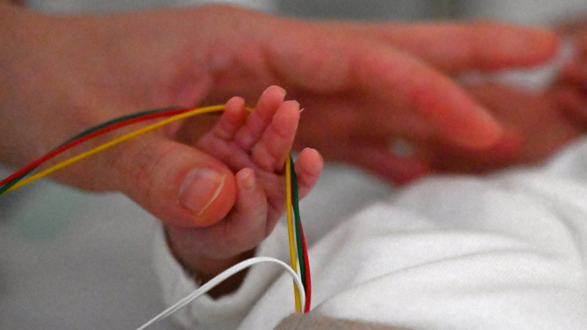 Frühchen haben heute bessere Überlebenschancen. Doch eine Langzeitstudie zeigt: Spätfolgen können bis ins Erwachsenenalter bleiben. | Bild: picture alliance/dpa | Jennifer Brückner Frühchen haben heute bessere Überlebenschancen. Doch eine Langzeitstudie zeigt: Spätfolgen können bis ins Erwachsenenalter bleiben.