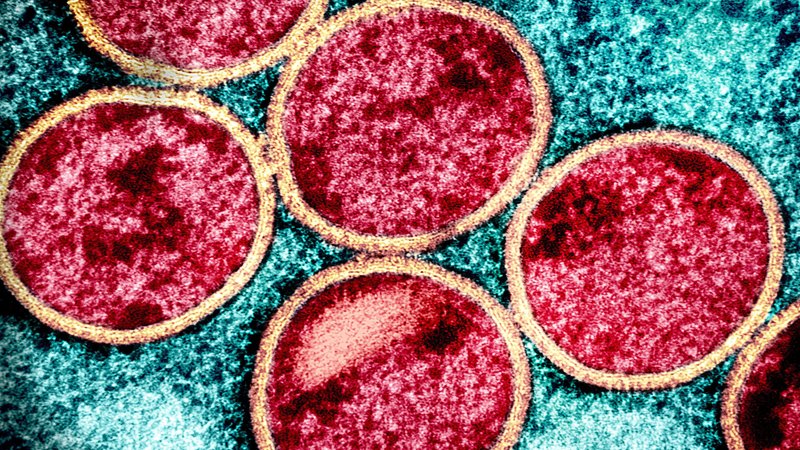 Kolorierte Transmissionselektronenmikroaufnahme von Affenpockenpartikeln (rot) in einer infizierten Zelle (blau), die im Labor kultiviert | Bild: picture alliance / BSIP | NIH-NIAID / IMAGE POINT FR Kolorierte Transmissionselektronenmikroaufnahme von Affenpockenpartikeln (rot) in einer infizierten Zelle (blau), die im Labor kultiviert