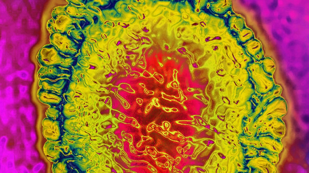 Coronavirus unter dem Miksroskop