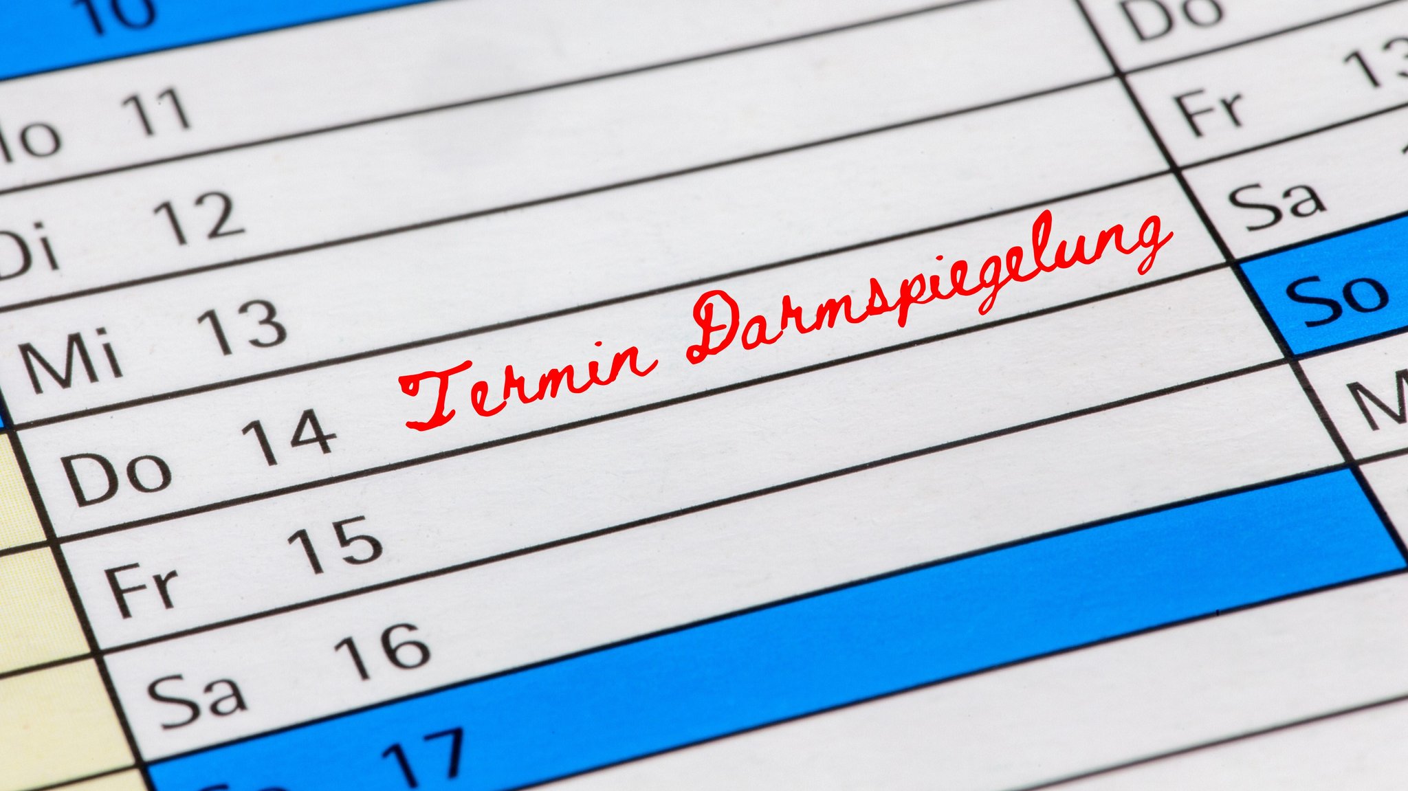 Ein Kalender mit Termin für eine Darmspiegelung. Sollten auch Jüngere zur Darmspiegelung? Neue Forschungsdaten warnen vor einer Zunahme von Darmkrebs bei jungen Menschen. Was steckt dahinter?