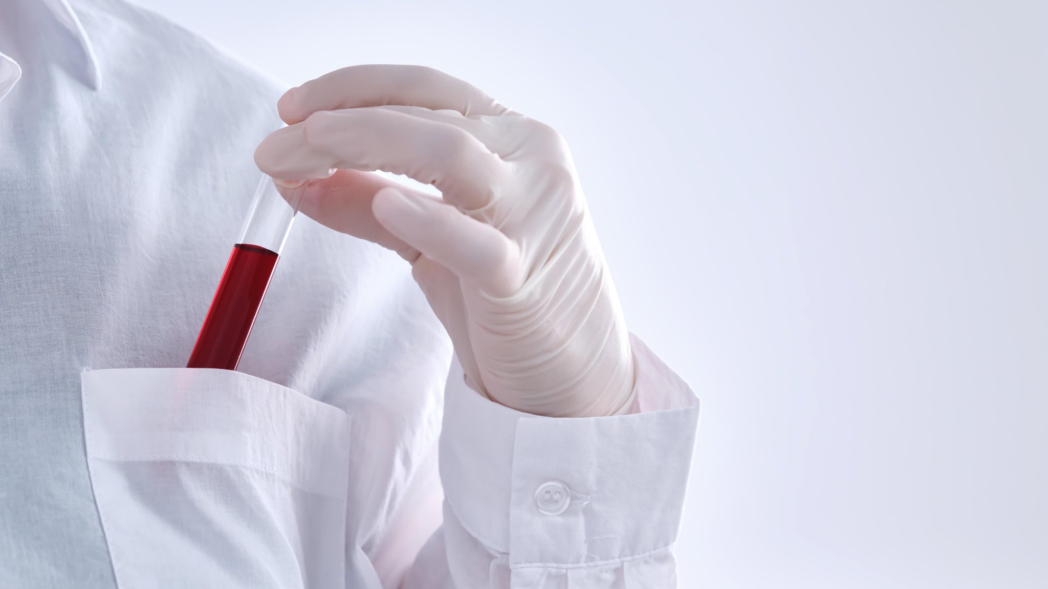Person in weißem Kittel mit Blutprobe | Bild: picture alliance / Zoonar | MAREVGENNA Person in weißem Kittel mit Blutprobe