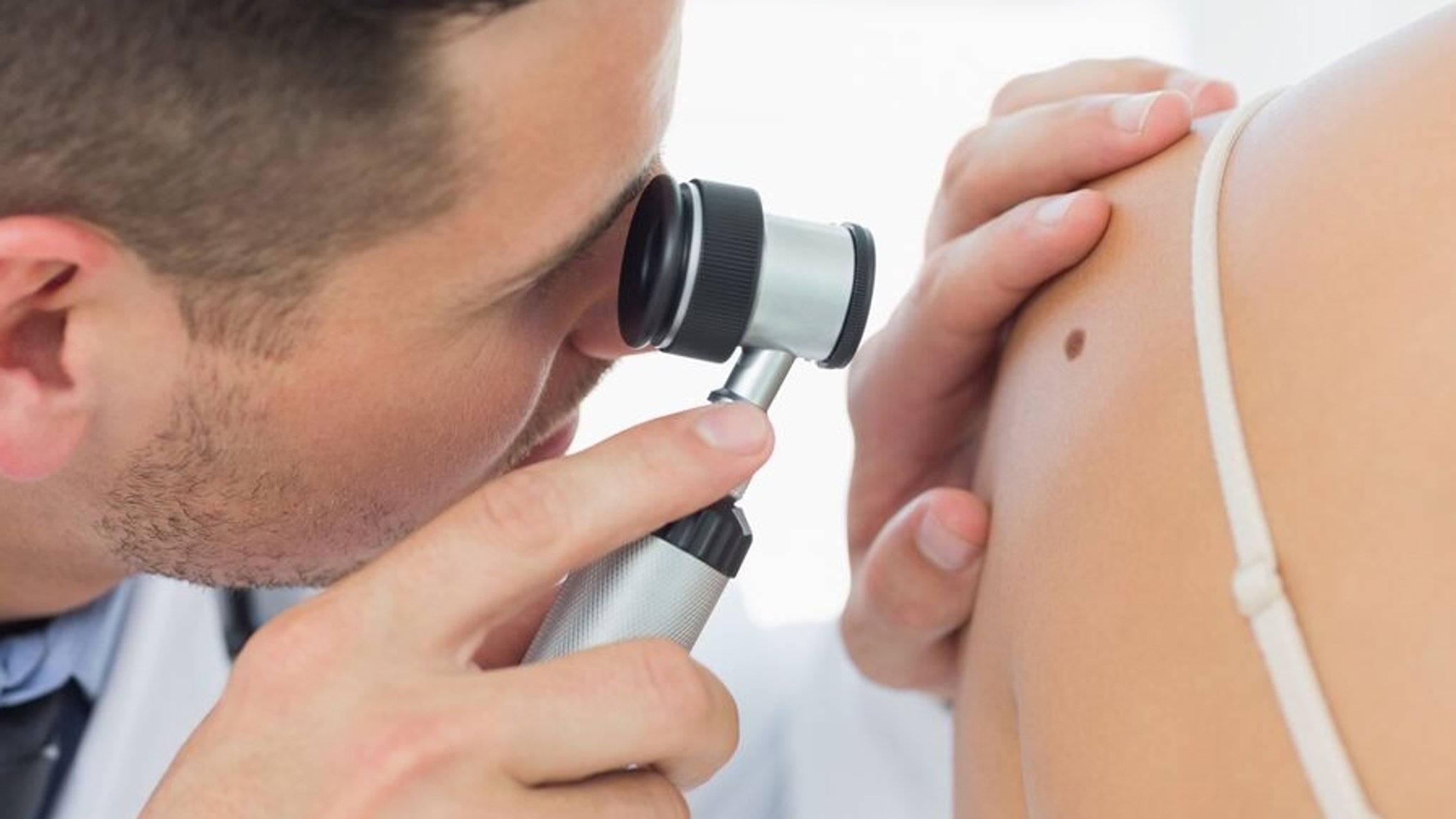(Symbolbild) Ein Dermatologe untersucht ein Muttermal auf der Haut einer Patientin.