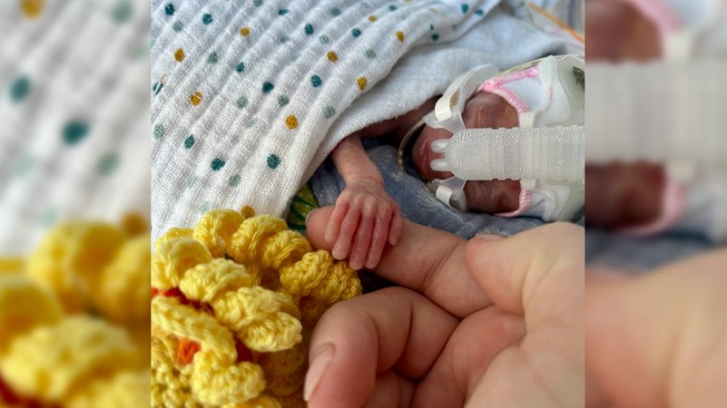 Die kleine Marie wog bei ihrer Geburt gerade mal 265 Gramm. | Bild: BR Die kleine Marie wog bei ihrer Geburt gerade mal 265 Gramm.