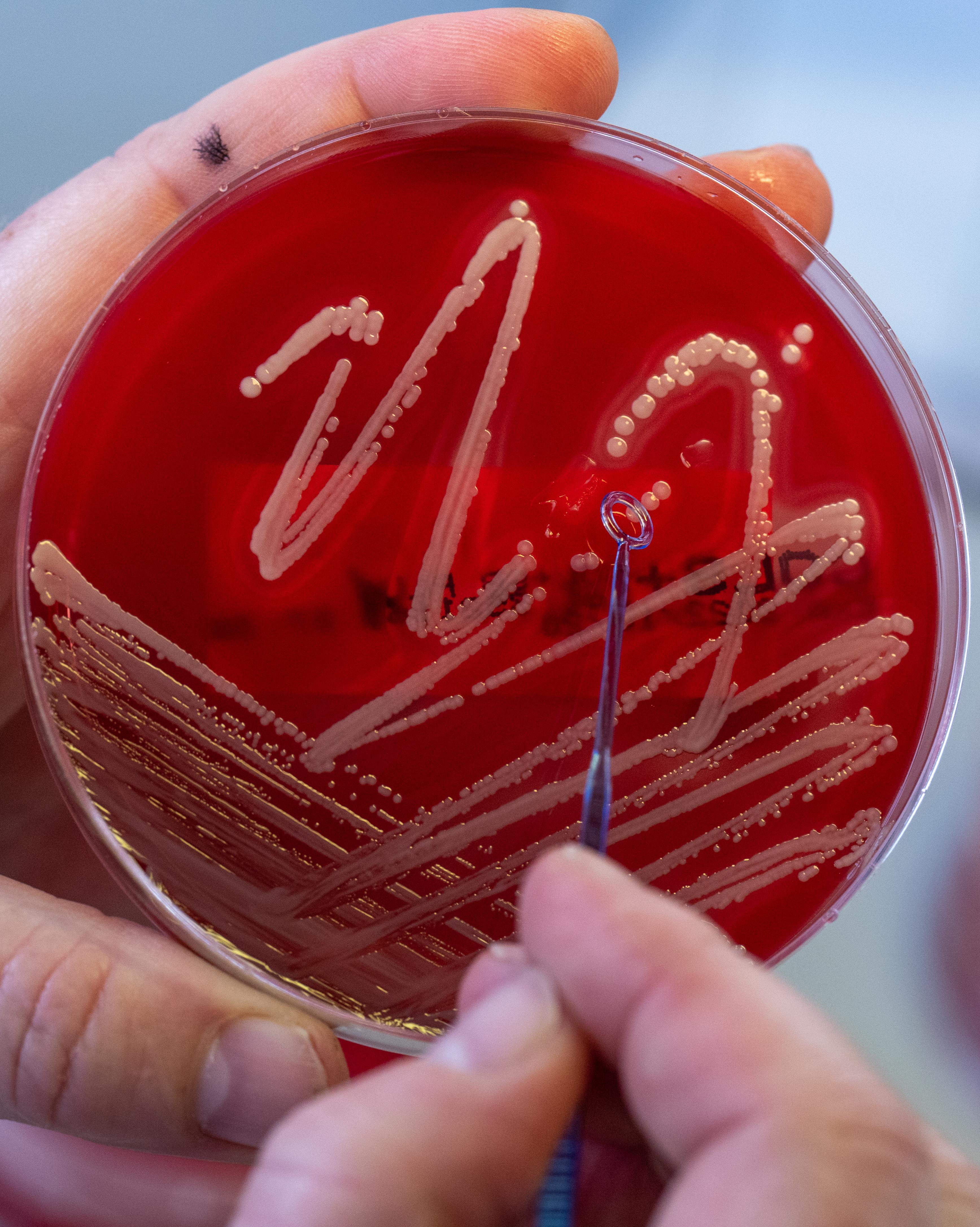 Kulturen des Bakteriums Staphylococcus aureus