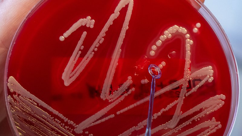 Kulturen des Bakteriums Staphylococcus aureus | Bild: picture alliance/ dpa/ Hendrik Schmidt Kulturen des Bakteriums Staphylococcus aureus