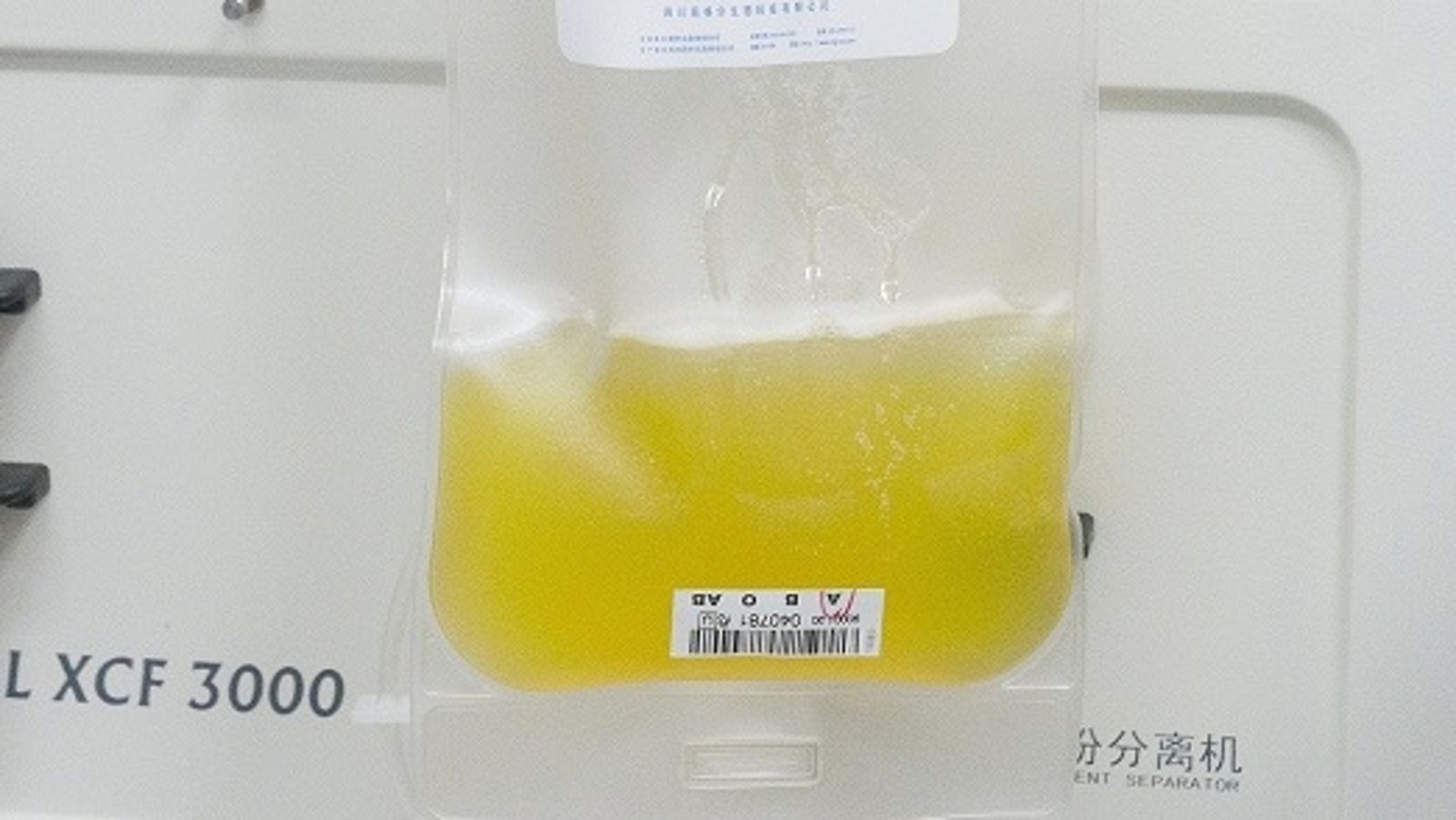 450 Corona Genesene Aus Unterfranken Wollen Blutplasma Spenden Br24