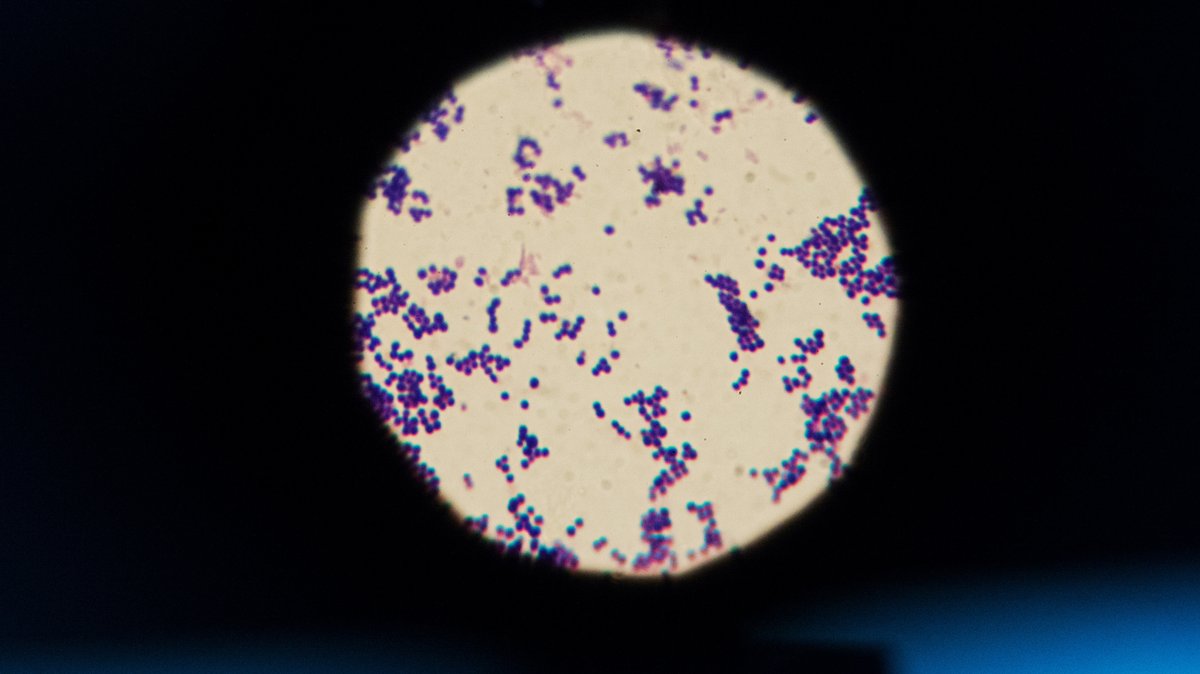 MRSA-Keime sind am 19.09.2017 im Institut für Hygiene und Gesundheit in Hamburg in 1000-facher Vergrößerung unter einem Mikroskop zu sehen. 