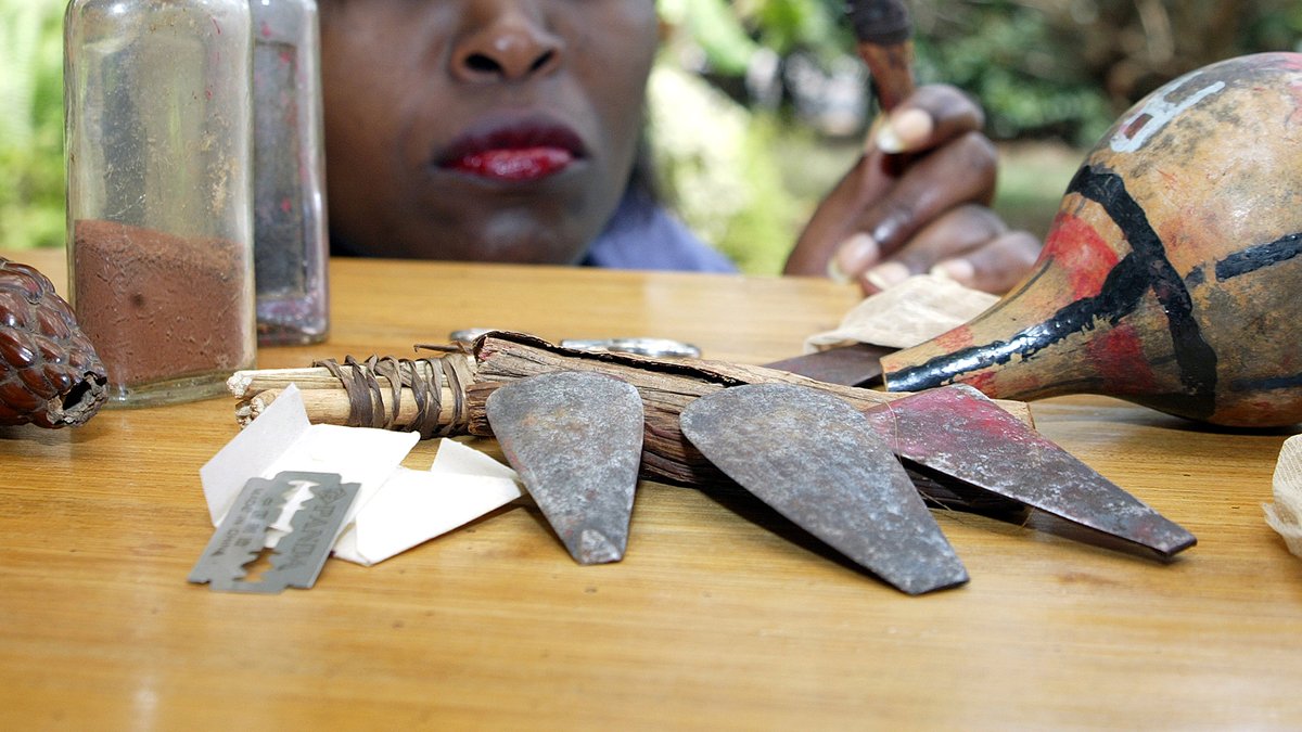 Somaliland stellt weibliche Genitalverstümmelung unter Strafe