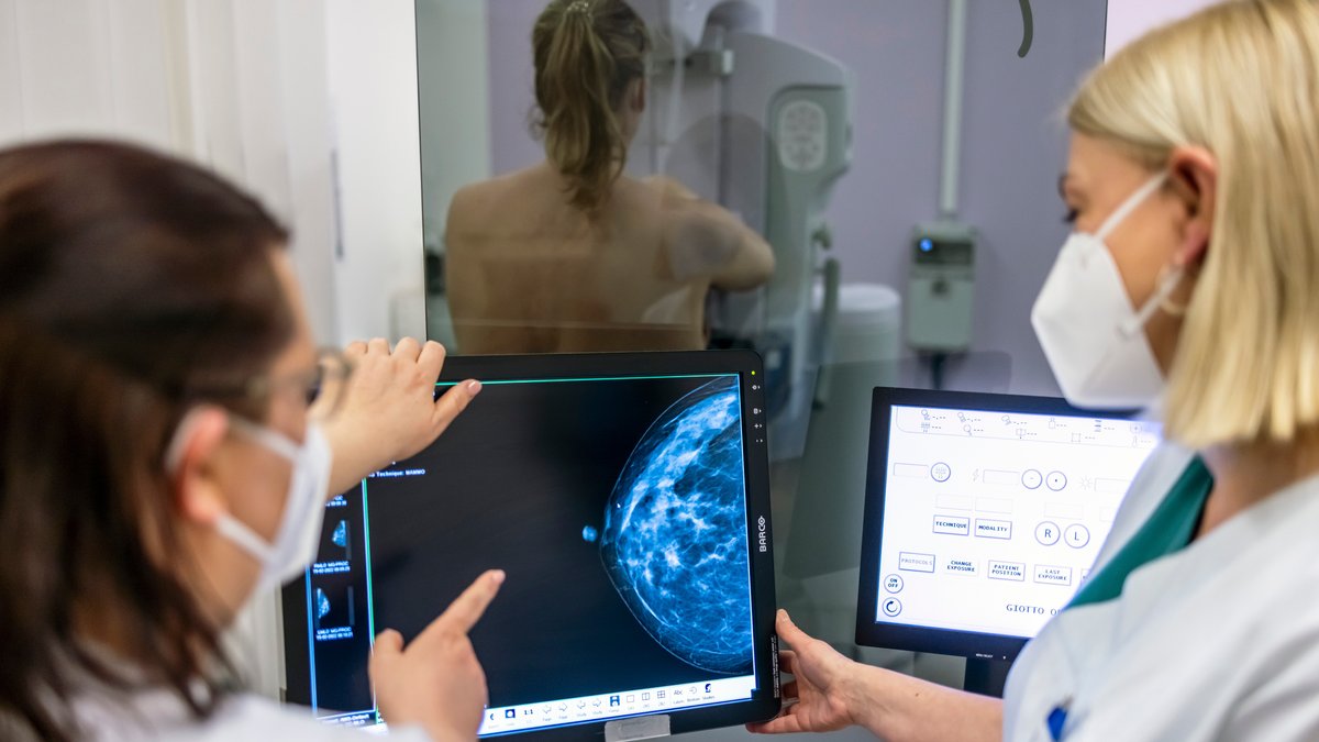 Medizinisches Personal untersucht mit einer Mammografie die Brust einer Frau auf Brustkrebs