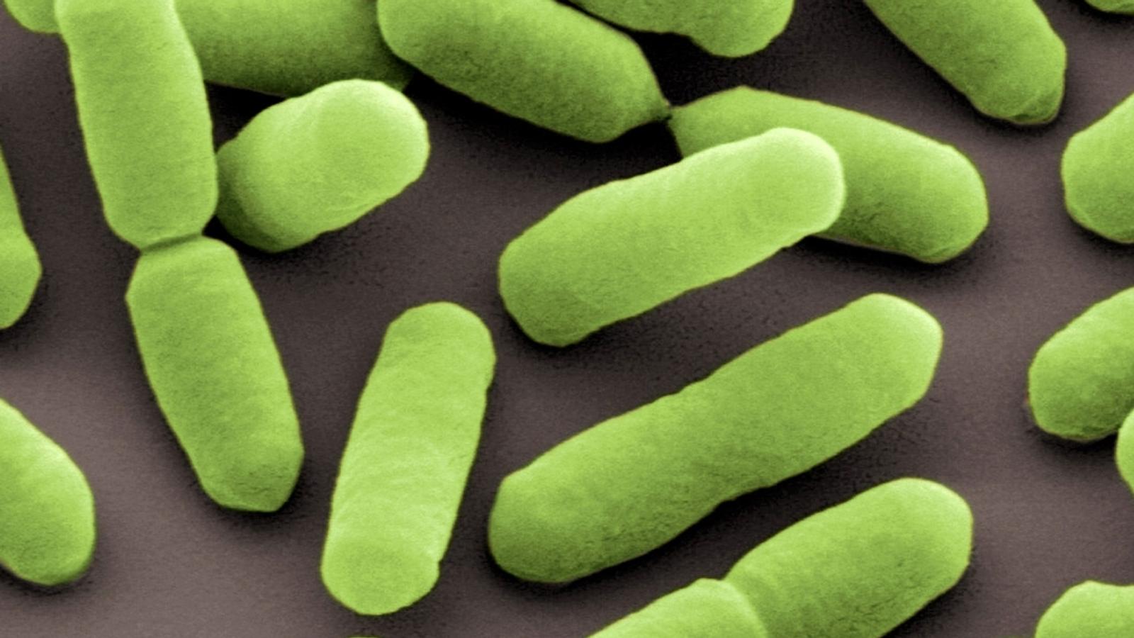 Zwei Menschen sind gestorben, weil sie mit Listerien verseuchte Wurst gegessen haben. Wo sind die Keime drin und wie kann man einer Infektion vorbeugen? Zwei Menschen sind gestorben, weil sie mit Listerien verseuchte Wurst gegessen haben. Wo sind die Keime drin und wie kann man einer Infektion vorbeugen?