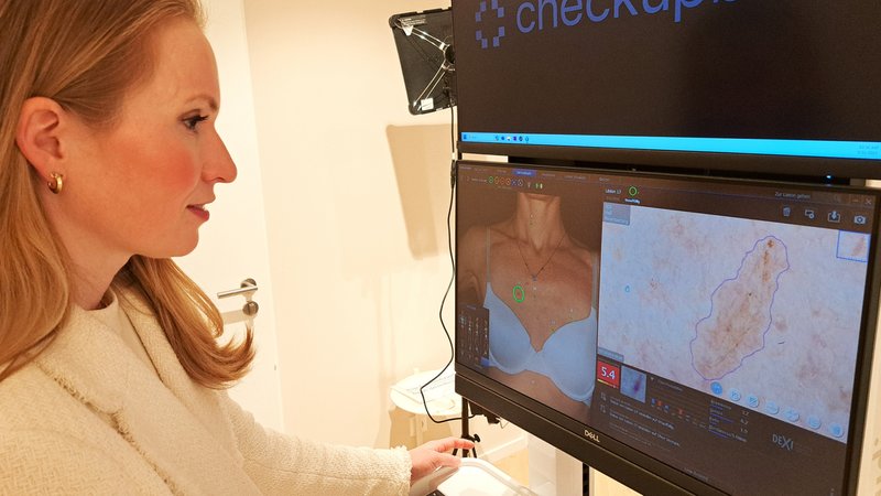 Hautärztin Cecilia Dietrich führt ein Gerät vor, das mit Hilfe von Künstlicher Intelligenz (KI) eine Ferndiagnose zur Hautkrebs-Früherkennung ermöglichen soll. | Bild: Jan Kerckhoff Hautärztin Cecilia Dietrich führt ein Gerät vor, das mit Hilfe von Künstlicher Intelligenz (KI) eine Ferndiagnose zur Hautkrebs-Früherkennung ermöglichen soll.