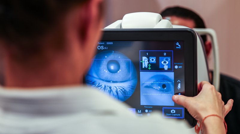 Auf einem Monitor sieht eine dm-Verkäuferin bei einem Augenscreening das Auge eines Kunden. | Bild: picture alliance/dpa | Christoph Reichwein Auf einem Monitor sieht eine dm-Verkäuferin bei einem Augenscreening das Auge eines Kunden.