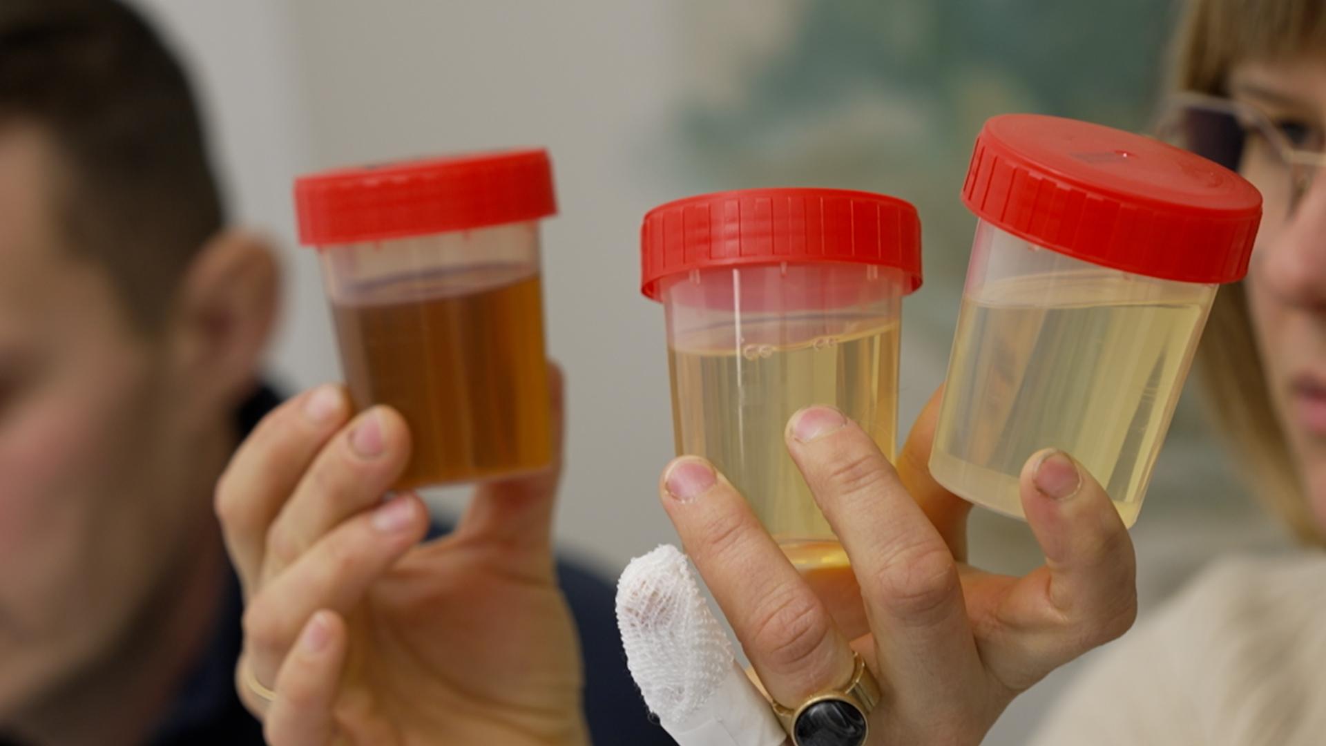 Drei durchsichtige Döschen mit rotem Deckel, gefüllt mit unterschiedlich gelb-braun gefärbten Flüssigkeiten.