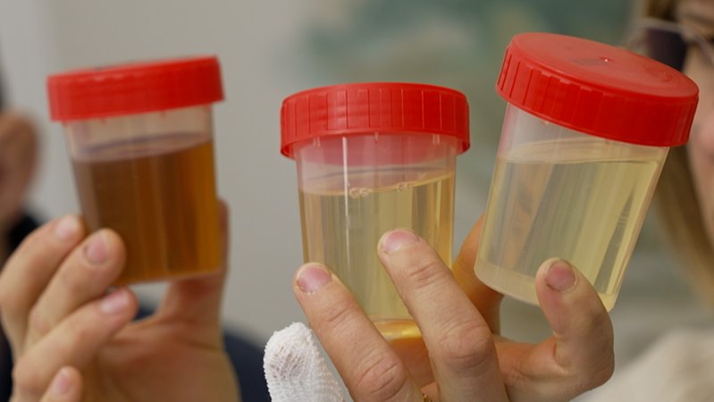 Drei durchsichtige Döschen mit rotem Deckel, gefüllt mit unterschiedlich gelb-braun gefärbten Flüssigkeiten. | Bild: BR/Kreutzer Drei durchsichtige Döschen mit rotem Deckel, gefüllt mit unterschiedlich gelb-braun gefärbten Flüssigkeiten.