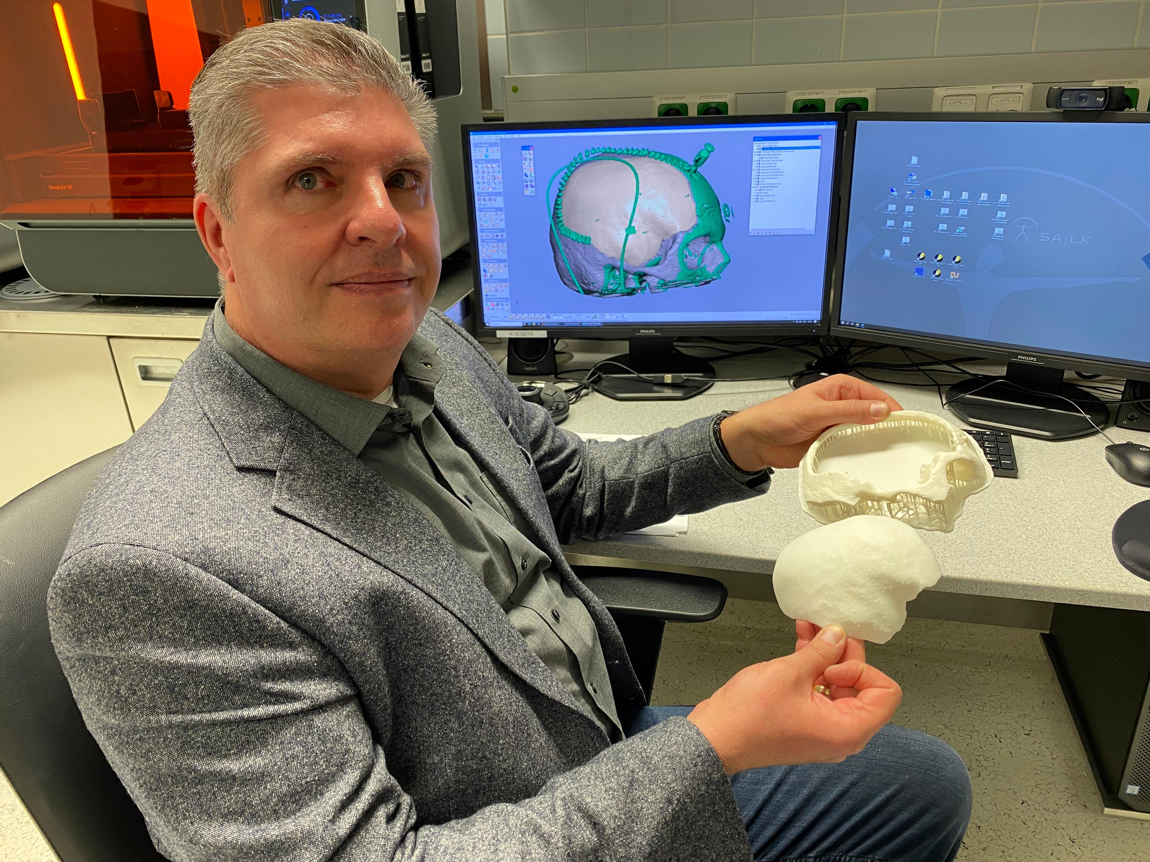 IT-Experte Werner Wurm mit dem Modell des Implantats, das Felix H. eingesetzt wurde.