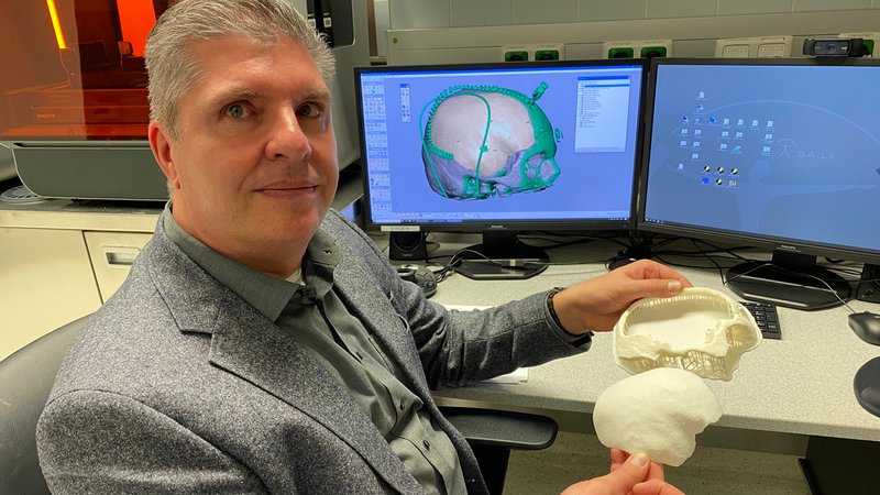 IT-Experte Werner Wurm mit dem Modell des Implantats, das Felix H. eingesetzt wurde. | Bild: Uniklinikum Salzburg IT-Experte Werner Wurm mit dem Modell des Implantats, das Felix H. eingesetzt wurde.