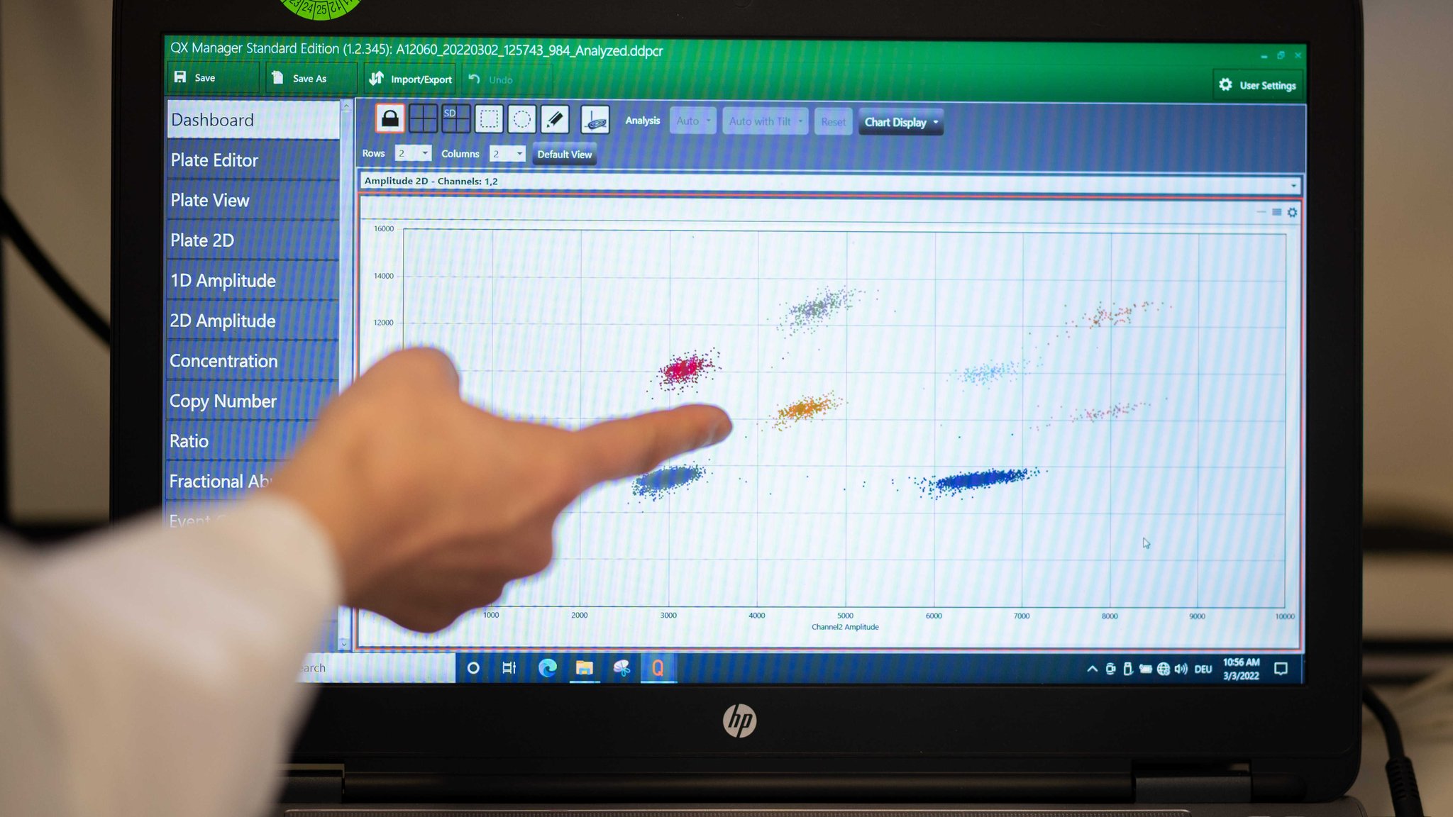 Eine Probenauswertung einer Abwasserprobe mit Nachweisen auf Virusgene sind in einem Labor auf einem Monitor zu sehen.