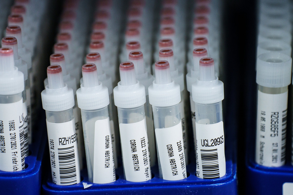 Kunststoffröhrchen mit Corona-Abstrichen stehen nach dem PCR-Test in einem Labor. 