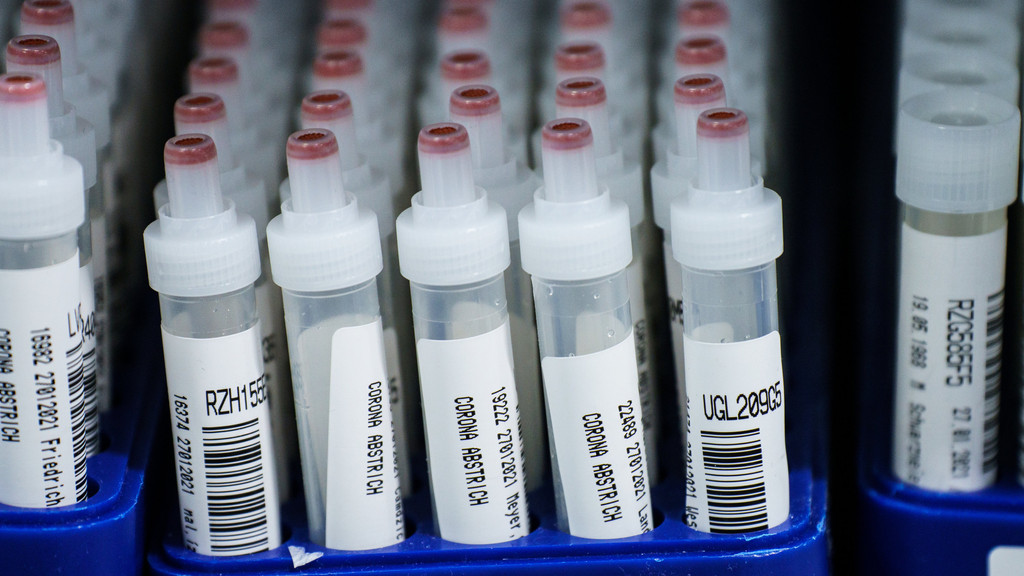 Kunststoffröhrchen mit Corona-Abstrichen stehen nach dem PCR-Test in einem Labor. 