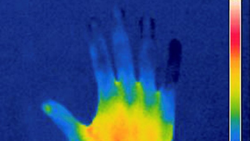 Thermographie einer menschlichen Hand (Symbolbild)