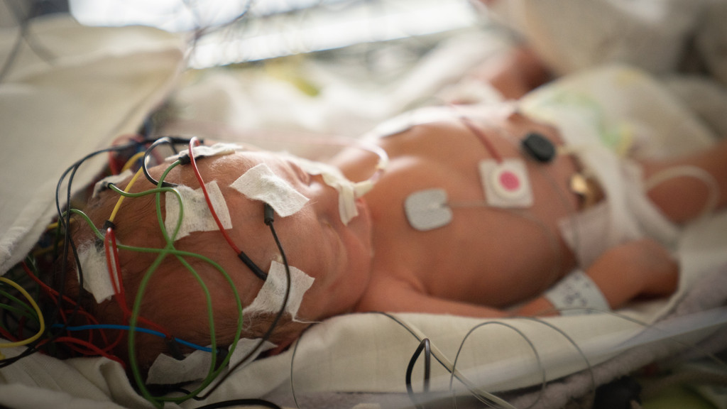 EKG-Schläuche an einem Frühgeborenen