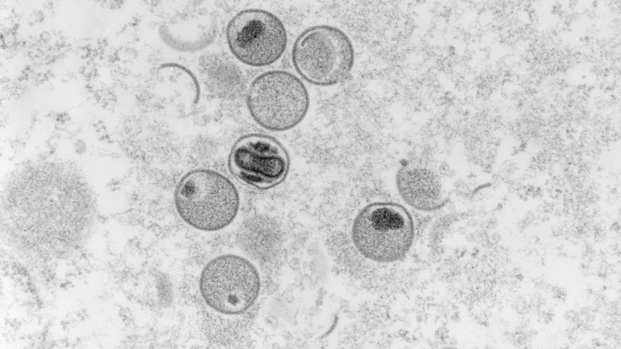Elektronenmikroskopische Aufnahme von Affenpocken-Viren