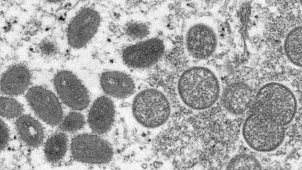 Diese elektronenmikroskopische Aufnahme aus dem Jahr 2003, die von den Centers for Disease Control and Prevention zur Verfügung gestellt wurde, zeigt reife, ovale Affenpockenviren (l) und kugelförmige unreife Virionen (r), die aus einer menschlichen Hautprobe im Zusammenhang mit dem Präriehundeausbruch von 2003 stammt.