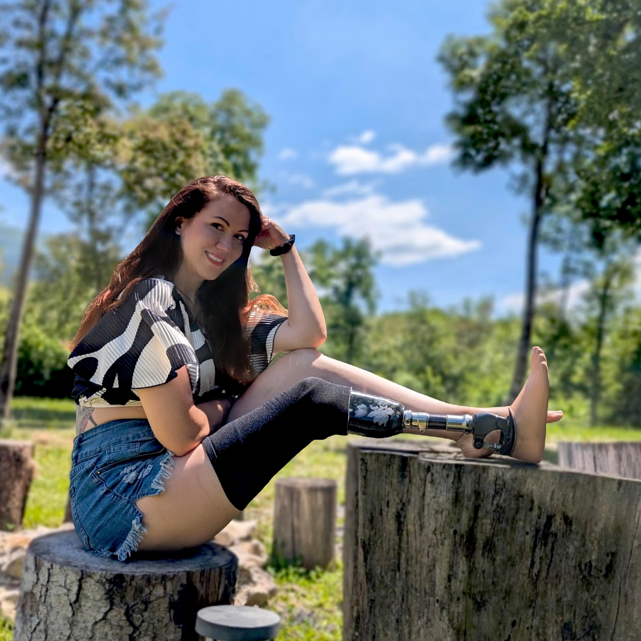 Eine Frau sitzt und zeigt ihre Unterschenkelprothese. 