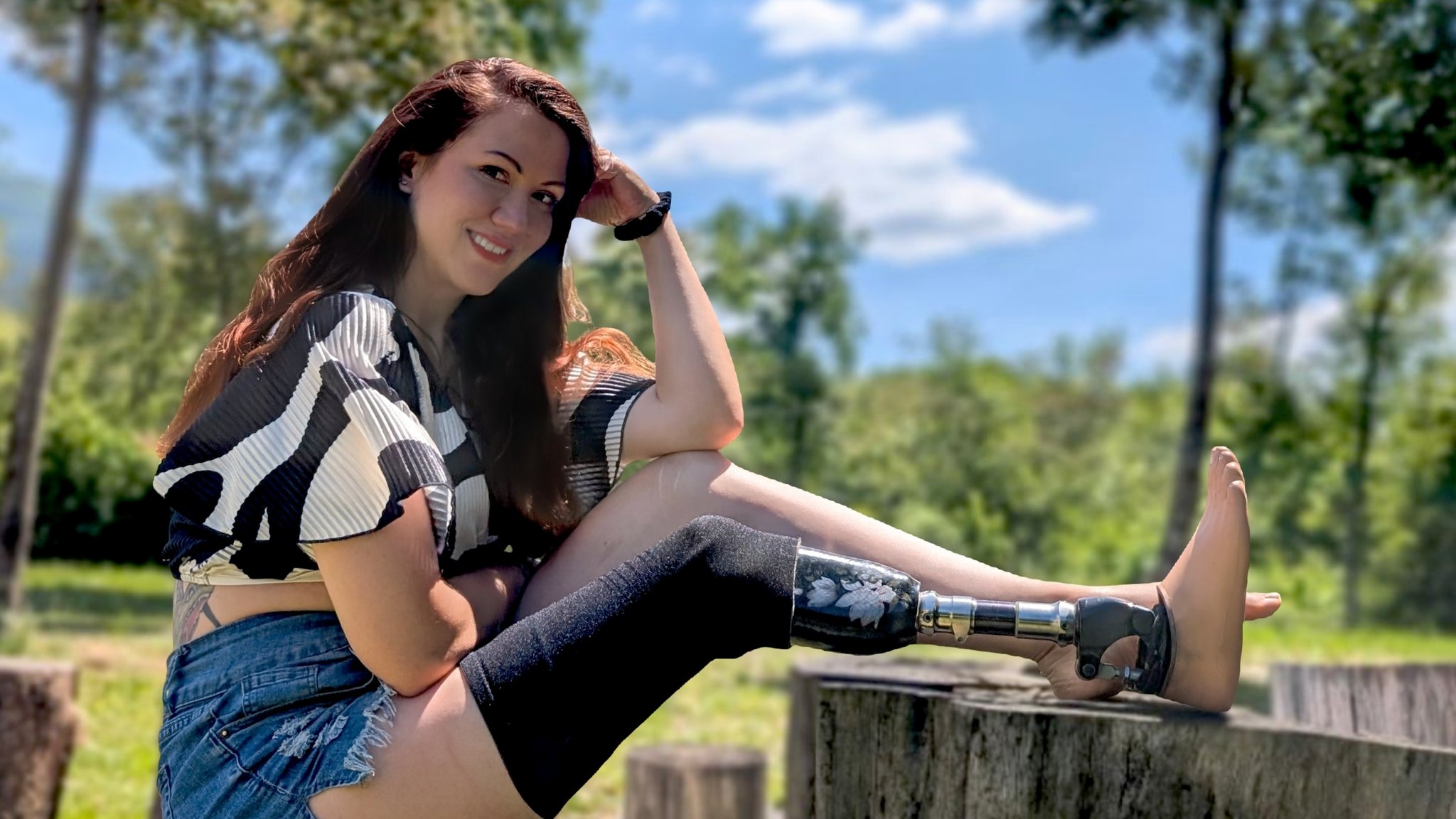 Eine Frau sitzt und zeigt ihre Unterschenkelprothese. 