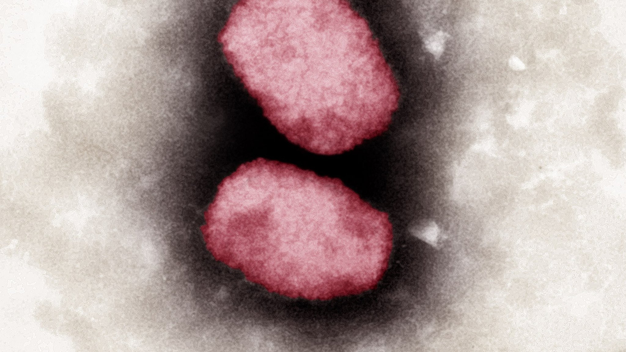 Elektronenmikroskopische Aufnahme von Affenpocken-Viren, koloriert.