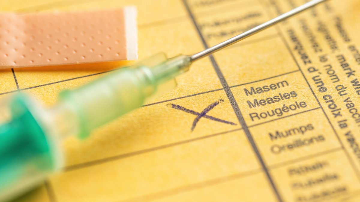 Masernalarm im Landkreis Erding: Warum schnelles Handeln zählt