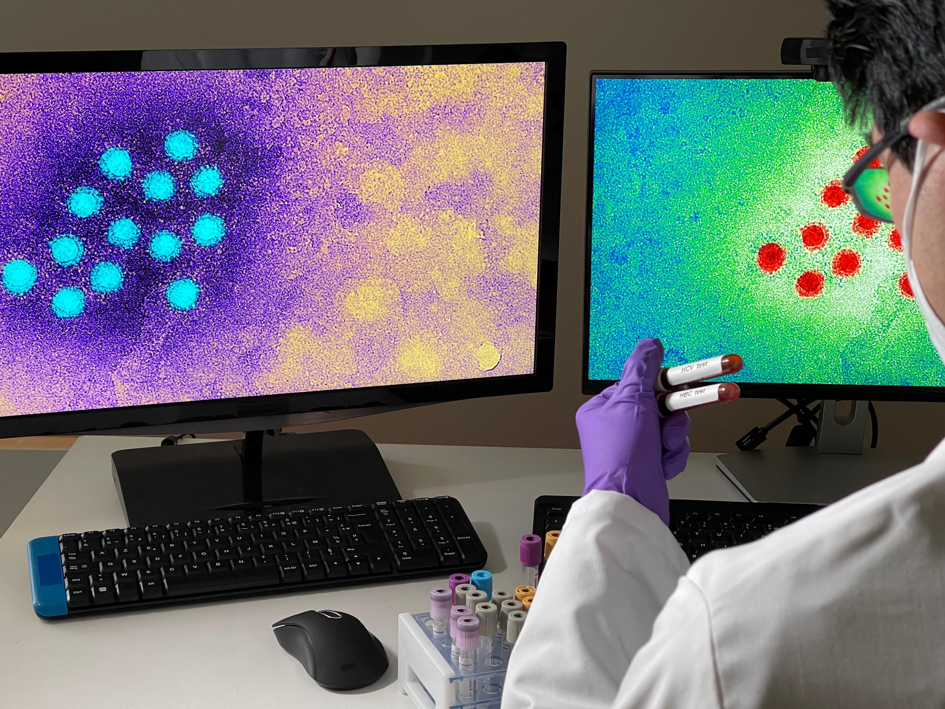 Ein Hepatitis-A-Virus, dargestellt auf einem Computer-Bildschirm