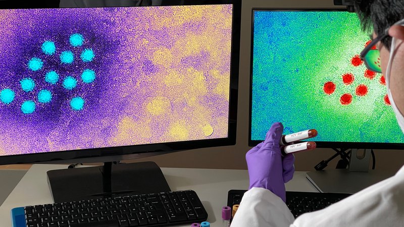 Ein Hepatitis-A-Virus, dargestellt auf einem Computer-Bildschirm | Bild: picture-alliance/dpa Ein Hepatitis-A-Virus, dargestellt auf einem Computer-Bildschirm