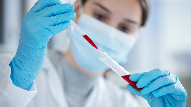 Eine Blutprobe wird untersucht. Eine neue Studie zeigt, dass die Chemikalien-Mischung in unserem Blut toxisch sein kann, auch wenn für die einzelnen Schadstoffe die Grenzwerte eingehalten sind. | Bild: colourbox.com Eine Blutprobe wird untersucht. Eine neue Studie zeigt, dass die Chemikalien-Mischung in unserem Blut toxisch sein kann, auch wenn für die einzelnen Schadstoffe die Grenzwerte eingehalten sind.